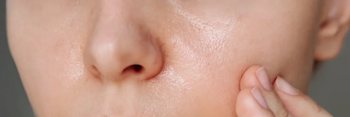 Mischhaut oder fettige Haut: Welche Anti-Falten-Pflegeprodukte wählen, ohne zu beschweren?