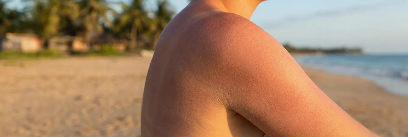 Soulager la peau après l’exposition au soleil ou l’épilation.