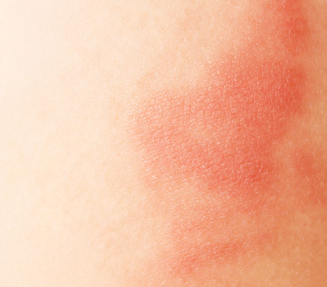 Routines_Resolutions_proteger_et_apaiser_ma_peau_fragilisee
